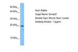 SNRNP27 Rabbit anti-Mouse, Polyclonal, Novus Biologicals 0.1ml; Unconjugated:Antibodies,